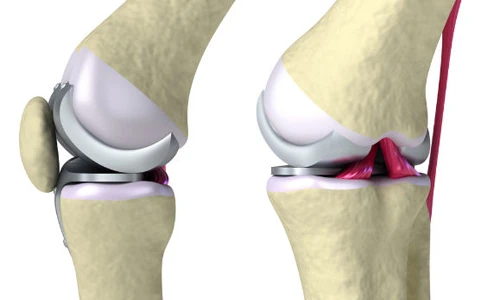 Dấu hiệu cảnh báo cơ thể đang thiếu kẽm trầm trọng