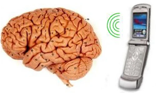 Sử dụng điện thoại đúng cách ngừa ung thư