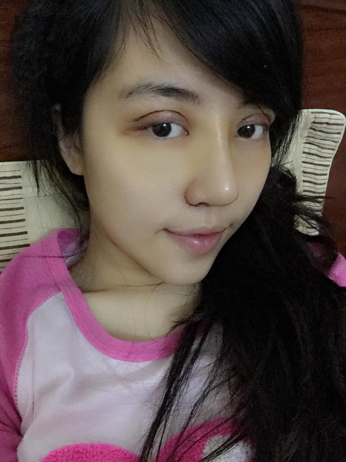 Quyết định này đến từ việc Minh Châu chưa bao giờ hài lòng với nhan sắc của mình. Bà mẹ 9X luôn coi làm đẹp là một quyền tối thiểu của phụ nữ, nhưng do điều kiện gia đình không khá giả nên đến bây giờ Minh Châu mới thực hiện được ý định.