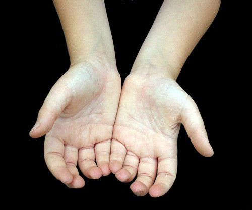Nếu lòng bàn tay có các đốm đỏ thì đây là dấu hiệu của sự giàu có. Các chấm đỏ trên tướng bán tay giàu có cho thấy bạn là người có khả năng gây dựng sự nghiệp từ con số 0 và kinh doanh rất giỏi.
