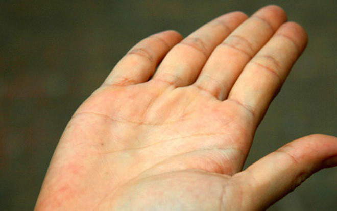 Lòng bàn tay đầy đặn và có tính đàn hồi. Người có lòng bàn tay đầy đặn thường khỏe mạnh, dồi dào sức sống. Dù trong công việc hay cuộc sống thì họ luôn tràn trề nhiệt huyết, nỗ lực thăng tiến.