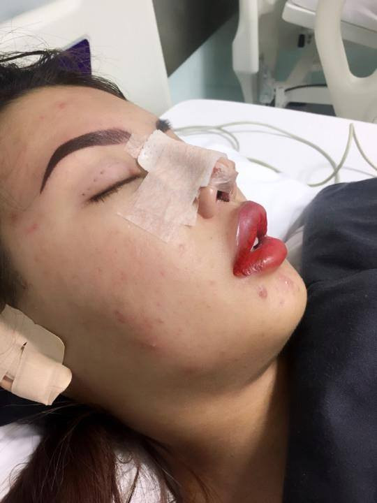 Trước đó, bà mẹ đơn thân khiến dư luận xôn xao khi chia sẻ những hình ảnh bản thân từng bị chê xấu như Thị Nở hóa thiên nga sau khi chi hơn 200 triệu đồng "dao kéo" làm đẹp.