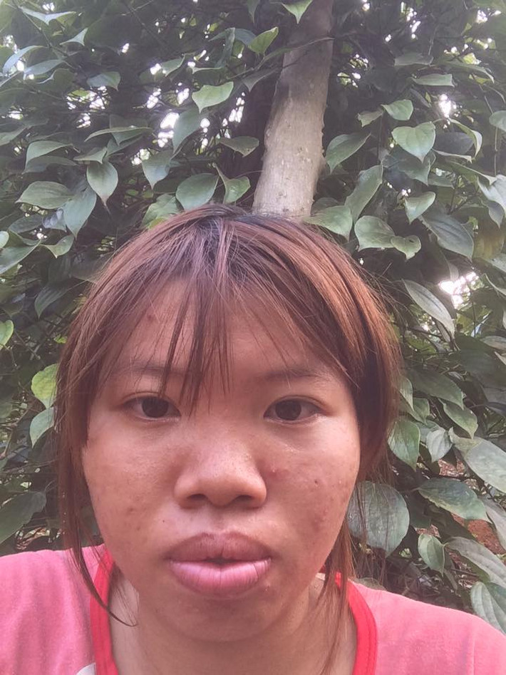 "Ngày trước chị 50kg. Nhưng chị cũng không phải ăn kiêng gì nhiều lắm. Mỗi bữa ăn giảm bớt chất bột và tăng cường ăn nhiều rau xanh, uống nhiều nước vì thế chị đã giảm được 8kg đó em" - Facebooker Thanh Thanh chia sẻ.