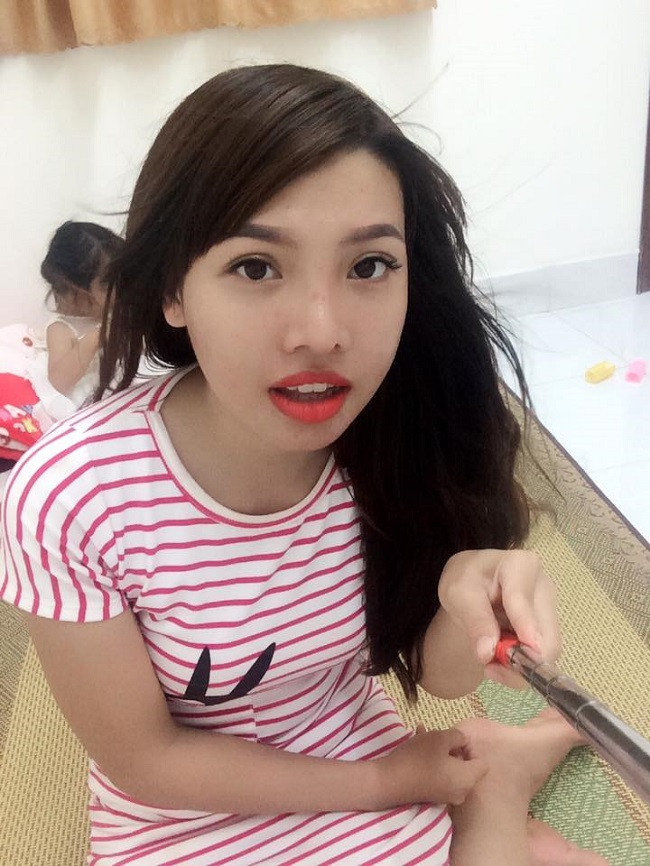 Kim Phượng thực hiện phẫu thuật tổng cộng 3 lần, gồm cắt hàm hô (65 triệu), hạ gò má (45 triệu), nhấn mí (3,5 triệu), nâng mũi cấu trúc (31 triệu), phun lông mày (2 triệu), xăm môi (2 triệu) cộng với tiền thuốc men.