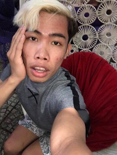 Quách Phượng từ một cô gái xấu xí bỗng nhiên đã trở nên xinh đẹp hơn nhiều.