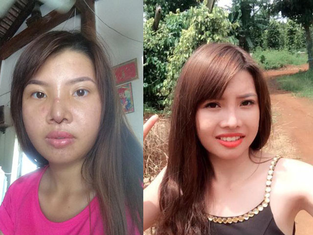 Trước Tùng Sơn, có một cô gái từng được ví với Thị Nở cũng đã chi 200 triệu để làm đẹp.