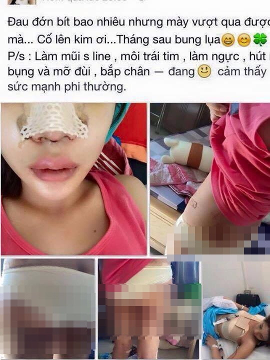 Để cải thiện được nhan sắc, tạo sự tự tin cho bản thân, cô gái trẻ tên Kim ở Hà Nội đã quyết định thực hiện "đại tu" cơ thể với một loạt ca phẫu thuật thẩm mỹ. Quá trình phẫu thuật thẩm mỹ đầy đau đớn được cô gái trẻ công khai trên mạng và khiến nhiều người xem không khỏi rùng mình.