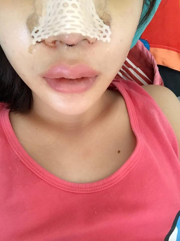 Thời gian gần đây, chuyện phụ nữ làm đẹp, phẫu thuật thẩm mỹ để thay đổi cuộc sống, tìm kiếm sự tự tin không còn là chuyện lạ. Nhưng những người chấp nhận phẫu thuật thẩm mỹ toàn thân trong cùng một thời điểm, quyết tâm vượt qua đau đớn, lột xác hoàn toàn như cô gái trẻ tên Kim lại không phải trường hợp phổ biến.