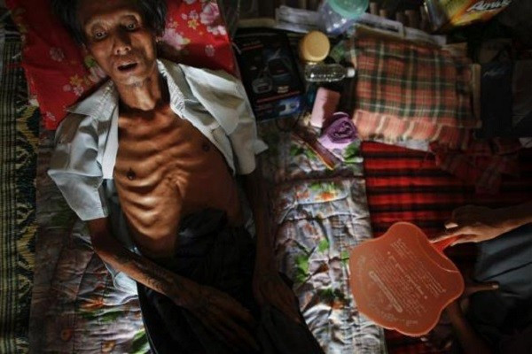 Đại dịch HIV/AIDS: HIV là virus gây hội chứng suy giảm miễn dịch ở người. Nếu không có hệ thống miễn dịch hoạt động tốt, những người bị HIV/AIDS sẽ dễ mắc phải những tổn thương khác, gây nhiễm trùng, dẫn đến tử vong. Virus lây lan qua máu và các chất dịch cơ thể. Hầu hết những người nhiễm virus đều qua quan hệ tình dục hoặc chia sẻ kim tiêm với người mang mầm bệnh. HIV/AIDS khiến 1,5 triệu người tử vong trong số 35 triệu người nhiễm bệnh. Ảnh: Asiasociety