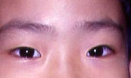 3. Lông mày mọc lộn xộn không đều: Người có lông mày mọc lộn xộn không đều thường là người có tính cách không ổn định, nóng lạnh bất thường, làm việc theo cảm tính, không chu đáo trong mọi việc, và tạo cho người khác cảm giác hung dữ, chuyện hôn nhân tình cảm của họ cũng không suôn sẻ.
