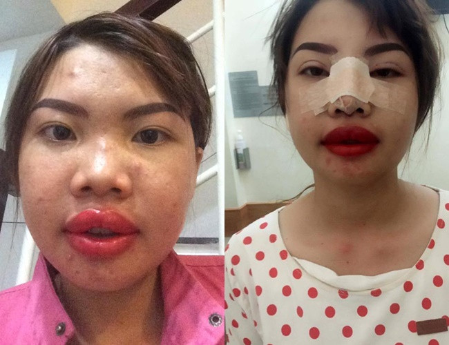 Ngay lập tức, câu chuyện về bà mẹ đơn thân xấu như 'Thị Nở tái sinh' quyết chí đập đi xây lại để tìm hạnh phúc mới nhận được sự quan tâm lớn của dân mạng Trung Quốc.