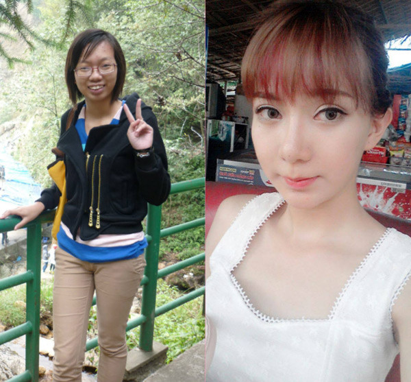 Lưu Thị Tuyết Nhung, cô gái Nam Định (sinh viên năm cuối Học viện Bưu chính Viễn thông Hà Nội) trước đây luôn rất tự ti bởi ngoại hình kém sắc, thậm chí bị cho là xấu xí của mình. Với đôi mắt dại, híp tịt vì cận nặng, làn da đen sạm và hàm răng hô... Tuyết Nhung thường bị khá nhiều bạn bè vô ý trêu chọc khiến bản thân cô mặc cảm, sống khép mình trong một thời gian dài. Chỉ sau khi được lựa chọn sang Hàn Quốc phẫu thuật thẩm mỹ mới đây, ngoại hình và cuộc sống của Tuyết Nhung mới thay đổi hoàn toàn.