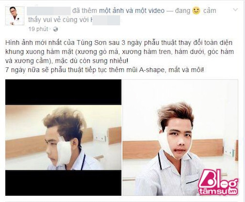 Từ sau khi video clip này được đăng tải, rất nhiều cư dân mạng tỏ ra tò mò, quan tâm về việc khuôn mặt thảm họa mạng Tùng Sơn sẽ cần can thiệp như thế nào, can thiệp những gì và đạt kết quả ra sao.