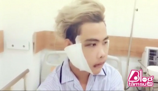 Được biết sau 10 ngày nghỉ ngơi tĩnh dưỡng, chàng trai này sẽ tiếp tục ca phẫu thuật chỉnh sữa mũi, mắt và môi.