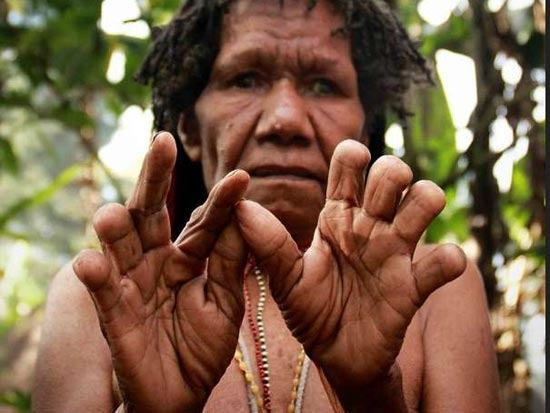 Tục cắt ngón tay (Ikipalin): Diễn ra tại Papua (tỉnh vùng Tây New Guinea, Indonesia), một nghi lễ khó tin tồn tại ở bộ lạc Dani. Những người phụ nữ Dani thực hiện Ikipalin, nghi lễ cắt cụt ngón tay sau cái chết của một người thân. Người Dani tin rằng bất hạnh do cái chết của một thành viên trong gia đình có thể được loại bỏ bằng cách cắt cụt ngón tay. Ảnh: Flickr. Người Dani rất coi trọng những người đã khuất, đặc biệt là người thân trong gia đình. Họ cũng quan niệm, việc người thân qua đời không chỉ là nỗi đau tinh thần mà còn là nỗi đau về thể xác. Ikipalin tượng trưng cho nỗi đau đó. Người Dani vẫn duy trì truyền thống này trong hàng nghìn năm nay và không có ý định thay đổi hay bỏ đi. Ảnh: News.kitook.co.id.