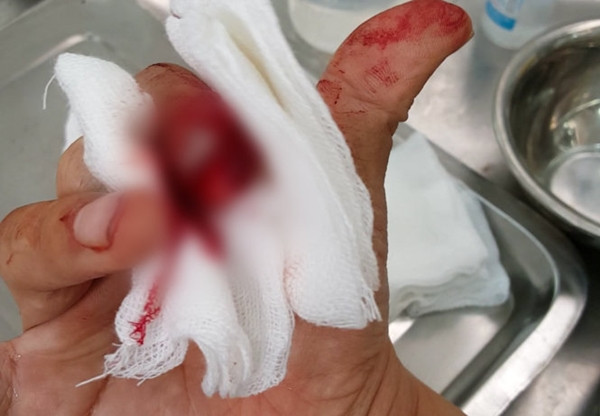 Nhà báo Đỗ Doãn Hoàng đã hô là đánh nhầm người nhưng các đối tượng vẫn dùng gậy vụt liên tiếp vào chân, tay. Khi thấy ông nằm bất động, ba kẻ lạ mặt mới bỏ đi. Ngay sau đó, ông phải nhờ một vài người dân chở ra đường vành đai 3 để bắt taxi đưa đến bệnh viện trong tình trạng nhiều vết bầm tím trên người, một ngón tay bị dập móng, chảy nhiều máu...