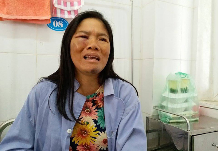 Trong khi đó, tại bệnh viện Sóc Sơn (Hà Nội), chị Bảy giờ đã tỉnh lại nhưng những vết thương trên cơ thể vẫn khiến chị cảm thấy đau đớn. Chị Bảy vẫn chưa hết sợ hãi, bàng hoàng sau khi bị đánh hội đồng vì nghi bắt cóc trẻ em.