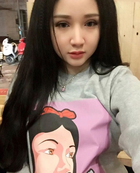 Nói về điều này, Dương Trà My thẳng thắn tiết lộ rằng cô có làm phẫu thuật thẩm mỹ.