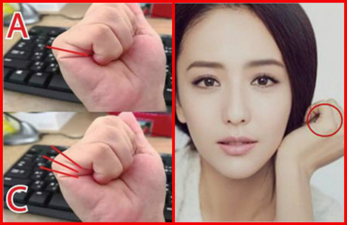 Có 3 đường chỉ. Những người có đặc điểm này thường sôi nổi, hào phóng, có khả năng lãnh đạo, nhưng bạn lại rất cứng nhắc, cố chấp, thích áp đặt suy nghĩ của mình cho người khác. Vận trình công việc của bạn khá hanh thông, nhưng nếu muốn thực sự giàu có thì bạn nên đầu tư kinh doanh, buôn bán.