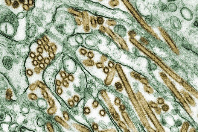Tiến sĩ Yoshihiro Kawaoka từng tiến hành một nghiên cứu biến đổi virus gây cúm gia cầm H5N1 thành một chủng virus có khả năng chống lại hệ thống miễn dịch của con người. Điều đáng sợ là nhà khoa học này gần như hoàn thành quá trình nghiên cứu trước khi nó bị chấm dứt do lo ngại về những tác động đến sức khỏe của toàn nhân loại.