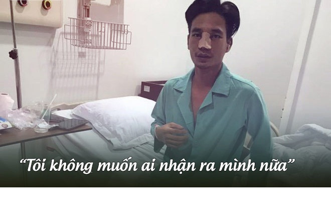 Tháng 7/2017, Lệ Rơi gây sốc khi công khai hình ảnh phẫu thuật thẩm mỹ. Anh muốn xóa bỏ hình ảnh "thảm họa âm nhạc" năm nào.
