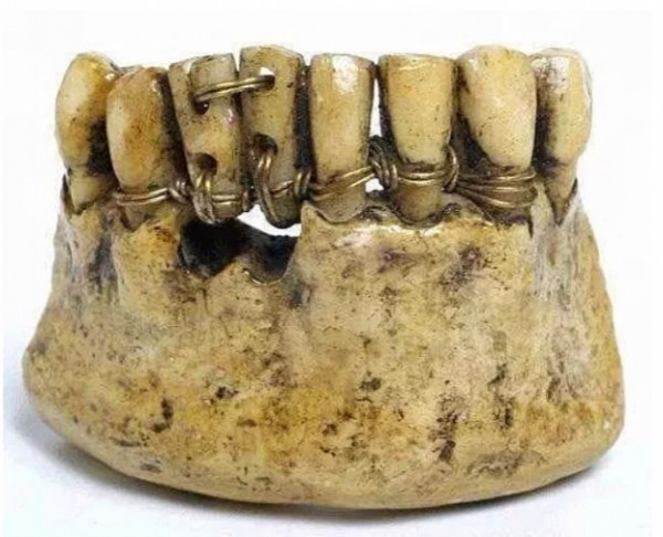 Và đây là cách làm răng giả.