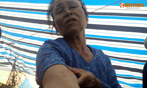 Theo người dân, sáng 3/8, sau khi thấy người dân xã Tân Tiến kéo ra phản đối, phía Công ty Môi trường đô thị Xuân Mai huy động khoảng 70 thanh niên lực lưỡng, xăm trổ đi trên hai chiếc ô tô 45 chỗ cùng nhiều taxi đến và xảy ra đụng độ, hành hung, lăng lạ, chửi bới người dân. Thậm chí, một số người già còn bị những nam thanh niên "hổ báo" bóp tay bầm tím, xô đẩy xuống mương nước dẫn đến bất tỉnh. Tuy nhiên, Chủ tịch UBND xã Tân Tiến - ông Nguyễn Văn Mạnh khẳng định: "Ngay sau khi xảy ra sự việc, cán bộ UBND xã, Công an xã, Công an huyện Chương Mỹ cũng đến hiện trường và thấy người của công ty Môi trường đô thị Xuân Mai và người dân đang tập trung đông dưới chân núi Thoong, giữa hai bên chưa có động thái gì".