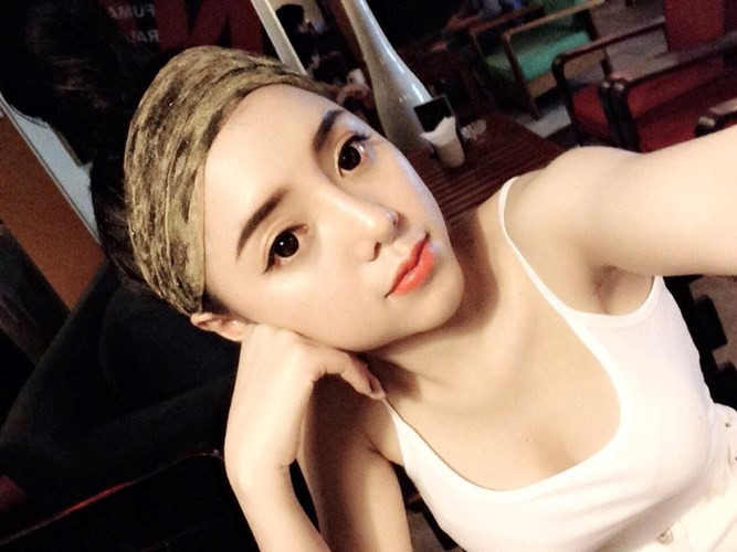 Qua trao đổi, cô đồng Lục Anh thừa nhận cô đã phẫu thuật thẩm mỹ, gần như "đập đi xây mới" khuôn mặt mình. Các ca phẫu thuật được thực hiện vào khoảng tháng 8 năm 2014. Nhan sắc thay đổi cùng với những quyết định táo bạo đã đưa Lục Anh đến với một công việc mới, càng khiến cô được nhiều người biết đến hơn.