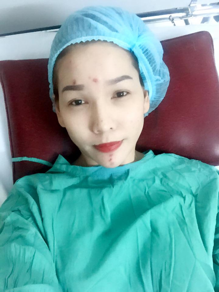 Tuy nhiên, sau khi phẫu thuật sửa mũi, dù bản thân Hoàng My hài lòng nhưng bạn bè của cô, cư dân mạng lại cho rằng ca phẫu thuật đã phản tác dụng. Một số dân mạng cho rằng khuôn mặt Hoàng My hiện tại còn... xấu hơn trước khi làm phẫu thuật sửa mũi.