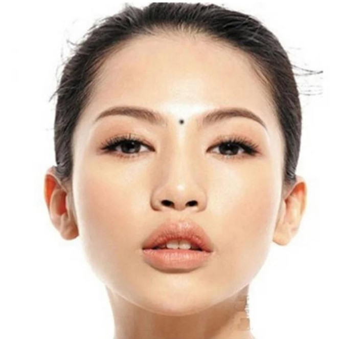 Khi ấn đường sáng người đó gặp may mắn, khi ấn đường tối màu, có sẹo nốt ruồi thì công việc, tài lộc dễ bị thua thiệt. Ngoài ra, người có nốt ruồi ở ấn đường nhân duyên vô cùng cao số. Tình duyên dễ đổ vỡ, dang dở, hoặc kết hôn muộn, khi về già cũng dễ đơn độc.