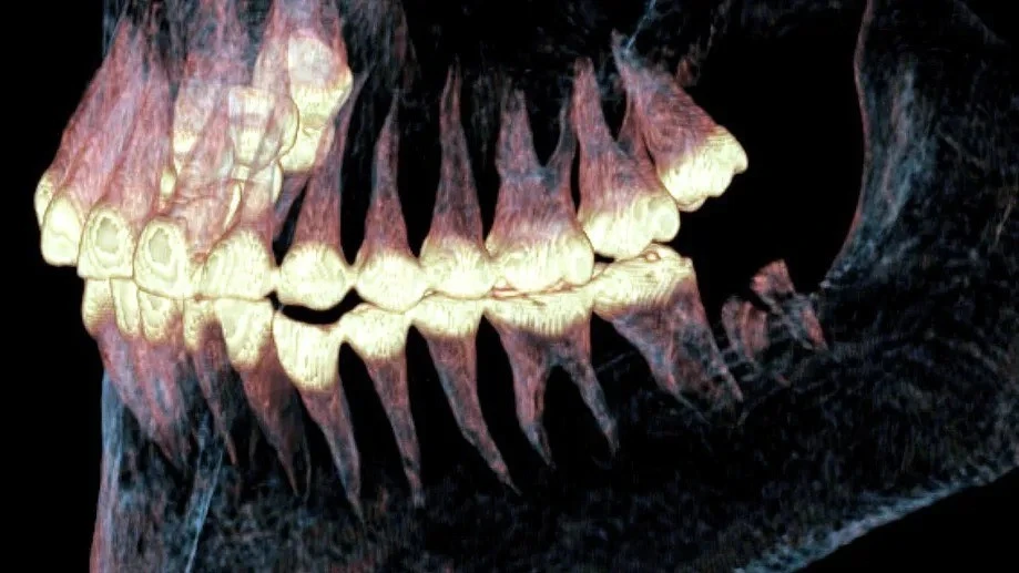 Chụp CT, phát hiện bất ngờ về thi hài phụ nữ Scythia 2.500 tuổi