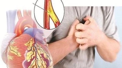 Dấu hiệu âm thầm cảnh báo bệnh tim