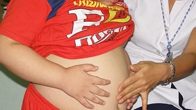 Học sinh TP HCM có tỷ lệ béo phì ở mức báo động