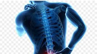 Nhóm thực phẩm người thoát vị đĩa đệm cần tránh
