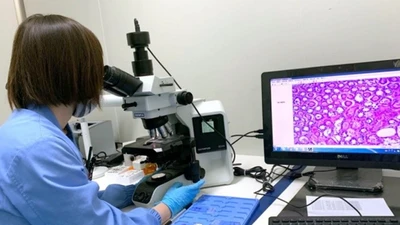 Xét nghiệm máu có thể phát hiện sớm nhiều loại ung thư