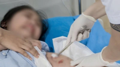 Bé gái 12 tuổi ở Phú Thọ bị chó cắn phải nhập viện