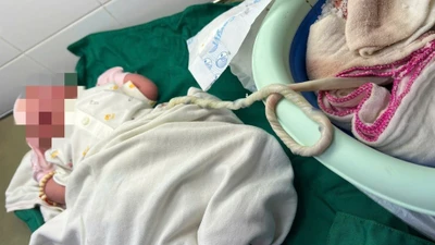 Hiểm họa sinh con tại nhà theo trào lưu "thuận tự nhiên" 