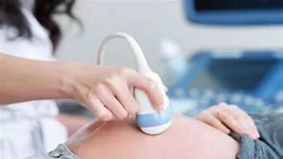 Đề xuất phạt 100 triệu nếu chọn giới tính thai nhi