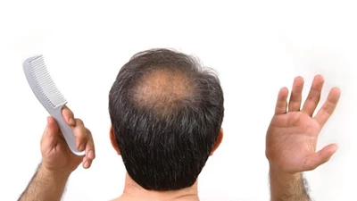 Nghiên cứu mới, đường deoxyribose có thể kích thích mọc tóc