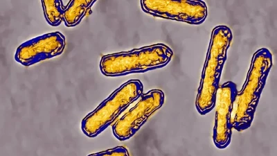 Vi khuẩn Listeria liên quan đến thực phẩm chế biến sẵn