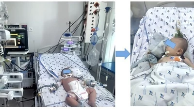 Cứu sống trẻ 7 tháng tuổi sốc sốt xuất huyết nặng