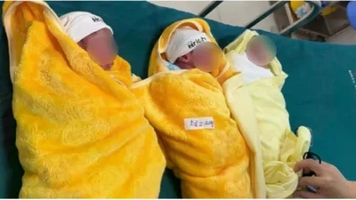 Mổ đẻ thành công ca sinh 3 tự nhiên hiếm gặp ở Quảng Trị