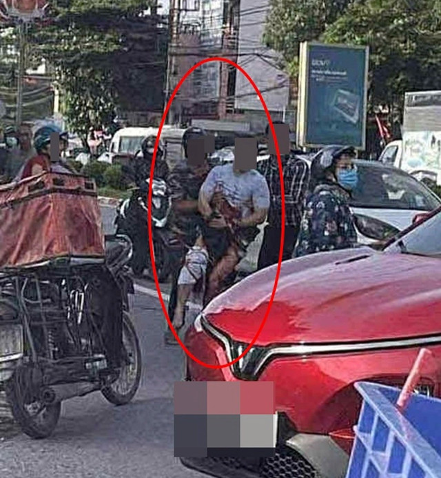 Một tiktoker ở Thái Nguyên bị nhóm giang hồ chém gần lìa bàn tay ở trên đường. Ảnh: MXH tiktok.jpg