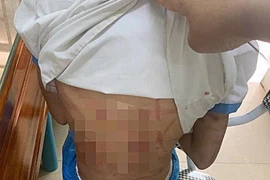 Cha dượng bạo hành bé gái lớp 5 có thể đối diện hình phạt nào?