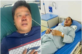 Danh tính kẻ hành hung dã man 2 anh em khi giúp người bị tai nạn