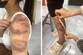 Kẻ bạo hành vợ mang thai và con gái 13 tuổi có thể đối mặt mức án nào?