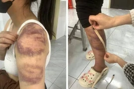 Kẻ bạo hành vợ mang thai và con gái 13 tuổi có thể đối mặt mức án nào?