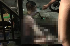 Nghi vấn chồng tẩm xăng thiêu vợ làm cả hai bị thương nặng