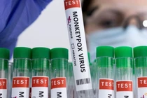 Bộ Y tế hướng dẫn người dân cách phòng tránh bệnh đậu mùa khỉ