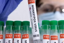 Bộ Y tế hướng dẫn người dân cách phòng tránh bệnh đậu mùa khỉ